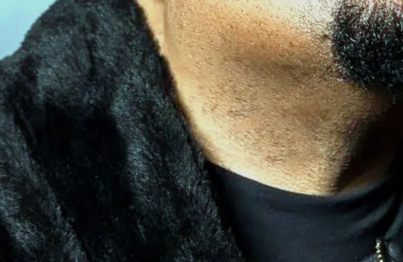 Arnez J